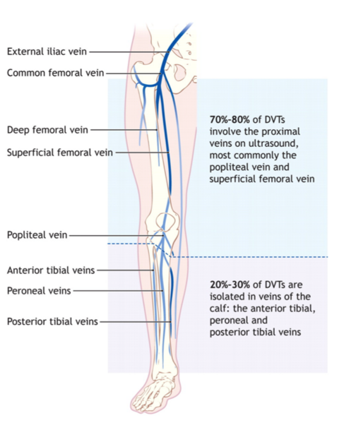 File:DVT Lower extremity.png
