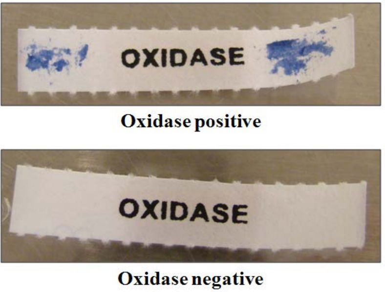 File:Positive vs Negative Reaction of Kovac's Oxidase Test.jpg