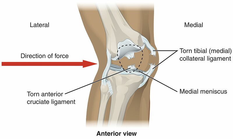 File:Knee Injury.jpg